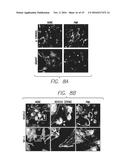 Sphingosine Kinase Type 1 Inhibitors and Uses Thereof diagram and image