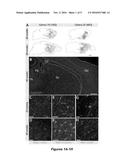 NON-HUMAN MAMMAL MODEL OF HUMAN DEGENERATIVE DISORDER, USES THEREOF, AND     METHOD OF TREATING HUMAN DEGENERATIVE DISORDER diagram and image