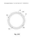 Releasable and Interchangeable Connections for Golf Club Heads and Shafts diagram and image