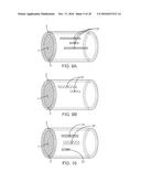 METHOD AND APPARATUS FOR MEASURING FLOW THROUGH A LUMEN diagram and image