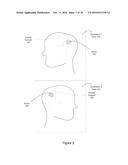 NON-INVASIVE METHOD FOR USING 2D ANGIOGRAPHIC IMAGES FOR RADIOSURGICAL     TARGET DEFINITION diagram and image