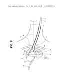 RIGID ENDOSCOPE FOR PROSTATE BIOPSY AND TREATMENT INSTRUMENT diagram and image