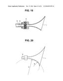 RIGID ENDOSCOPE FOR PROSTATE BIOPSY AND TREATMENT INSTRUMENT diagram and image