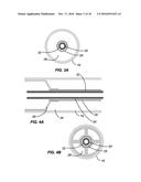 CRYOGENIC BALLOON ABLATION SYSTEM diagram and image