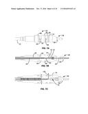 CRYOGENIC BALLOON ABLATION SYSTEM diagram and image