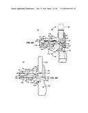 CRYOGENIC BALLOON ABLATION SYSTEM diagram and image