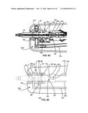 CRYOGENIC BALLOON ABLATION SYSTEM diagram and image