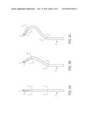 ELECTRODE CATHETER FOR ABLATION PURPOSES AND RELATED METHOD THEREOF diagram and image