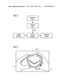 DEVICE AND METHOD FOR THE COMPUTER-ASSISTED SIMULATION OF SURGICAL     INTERVENTIONS diagram and image