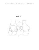 SYSTEM AND METHOD FOR SIMULATING RECONSTRUCTIVE SURGERY OF ANTERIOR     CRUCIATE LIGAMENT USING MEDICAL IMAGES diagram and image