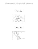 SYSTEM AND METHOD FOR SIMULATING RECONSTRUCTIVE SURGERY OF ANTERIOR     CRUCIATE LIGAMENT USING MEDICAL IMAGES diagram and image