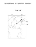 SYSTEM AND METHOD FOR SIMULATING RECONSTRUCTIVE SURGERY OF ANTERIOR     CRUCIATE LIGAMENT USING MEDICAL IMAGES diagram and image