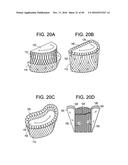 PROSTHETIC VALVES AND RELATED INVENTIONS diagram and image