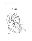 PROSTHETIC VALVES AND RELATED INVENTIONS diagram and image