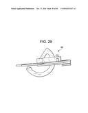 PROSTHETIC VALVES AND RELATED INVENTIONS diagram and image