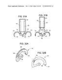 PROSTHETIC VALVES AND RELATED INVENTIONS diagram and image