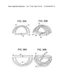 PROSTHETIC VALVES AND RELATED INVENTIONS diagram and image