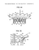 PROSTHETIC VALVES AND RELATED INVENTIONS diagram and image