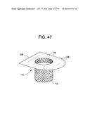 PROSTHETIC VALVES AND RELATED INVENTIONS diagram and image