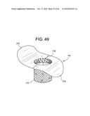 PROSTHETIC VALVES AND RELATED INVENTIONS diagram and image