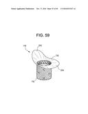 PROSTHETIC VALVES AND RELATED INVENTIONS diagram and image