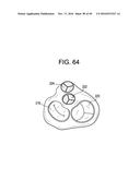 PROSTHETIC VALVES AND RELATED INVENTIONS diagram and image