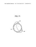 PROSTHETIC VALVES AND RELATED INVENTIONS diagram and image