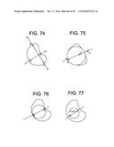 PROSTHETIC VALVES AND RELATED INVENTIONS diagram and image