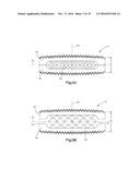 EXPANDABLE INTERVERTEBRAL IMPLANT AND ASSOCIATED METHOD OF MANUFACTURING     THE SAME diagram and image