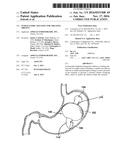 Intragastric Balloon for Treating Obesity diagram and image