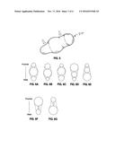 Intragastric Balloon for Treating Obesity diagram and image