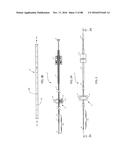 Devices for Clearing Blockages in Artificial and Natural Lumens diagram and image