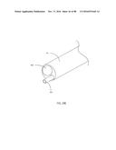 Devices for Clearing Blockages in Artificial and Natural Lumens diagram and image