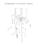 Devices for Clearing Blockages in Artificial and Natural Lumens diagram and image