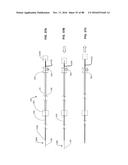 Devices for Clearing Blockages in Artificial and Natural Lumens diagram and image