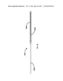 Devices for Clearing Blockages in Artificial and Natural Lumens diagram and image