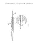 Devices for Clearing Blockages in Artificial and Natural Lumens diagram and image