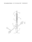 Devices for Clearing Blockages in Artificial and Natural Lumens diagram and image