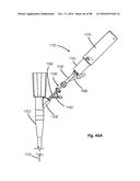 Devices for Clearing Blockages in Artificial and Natural Lumens diagram and image