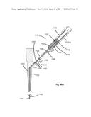 Devices for Clearing Blockages in Artificial and Natural Lumens diagram and image