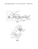 Devices for Clearing Blockages in Artificial and Natural Lumens diagram and image