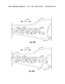 Devices for Clearing Blockages in Artificial and Natural Lumens diagram and image