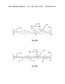 Devices for Clearing Blockages in Artificial and Natural Lumens diagram and image