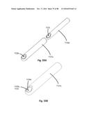 Devices for Clearing Blockages in Artificial and Natural Lumens diagram and image