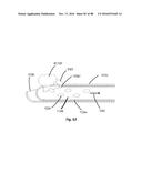 Devices for Clearing Blockages in Artificial and Natural Lumens diagram and image