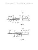 Devices for Clearing Blockages in Artificial and Natural Lumens diagram and image