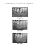 ANTIOXIDANT COMPOSITIONS FOR TREATMENT OF INFLAMMATION OR OXIDATIVE DAMAGE diagram and image