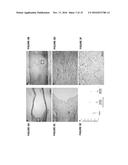 PLURIPOTENT STEM CELL-DERIVED OLIGODENDROCYTE PROGENITOR CELLS FOR THE     TREATMENT OF SPINAL CORD INJURY diagram and image