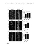 THERAPEUTIC USE OF VEGFR-3 LIGANDS diagram and image