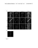 THERAPEUTIC USE OF VEGFR-3 LIGANDS diagram and image